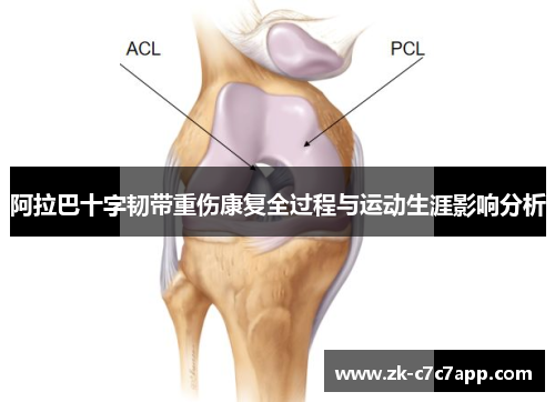 阿拉巴十字韧带重伤康复全过程与运动生涯影响分析 阿拉巴十字韧带重伤康复全过程与运动生涯影响分析